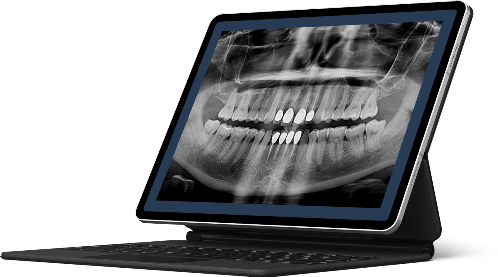 Trimite radiografia pe WhatsApp