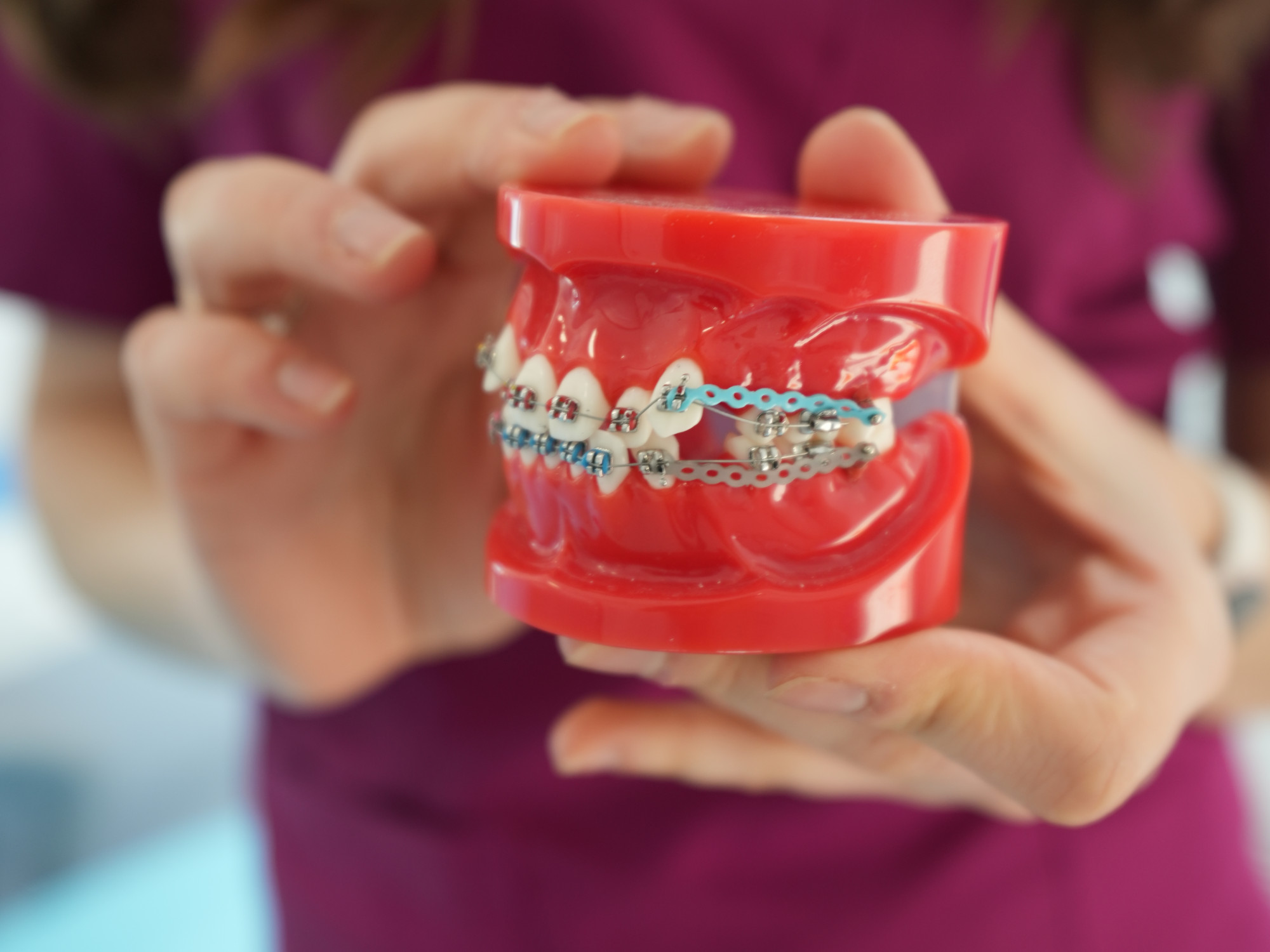 International Dental Clinic Tratament ortodontic în Iași