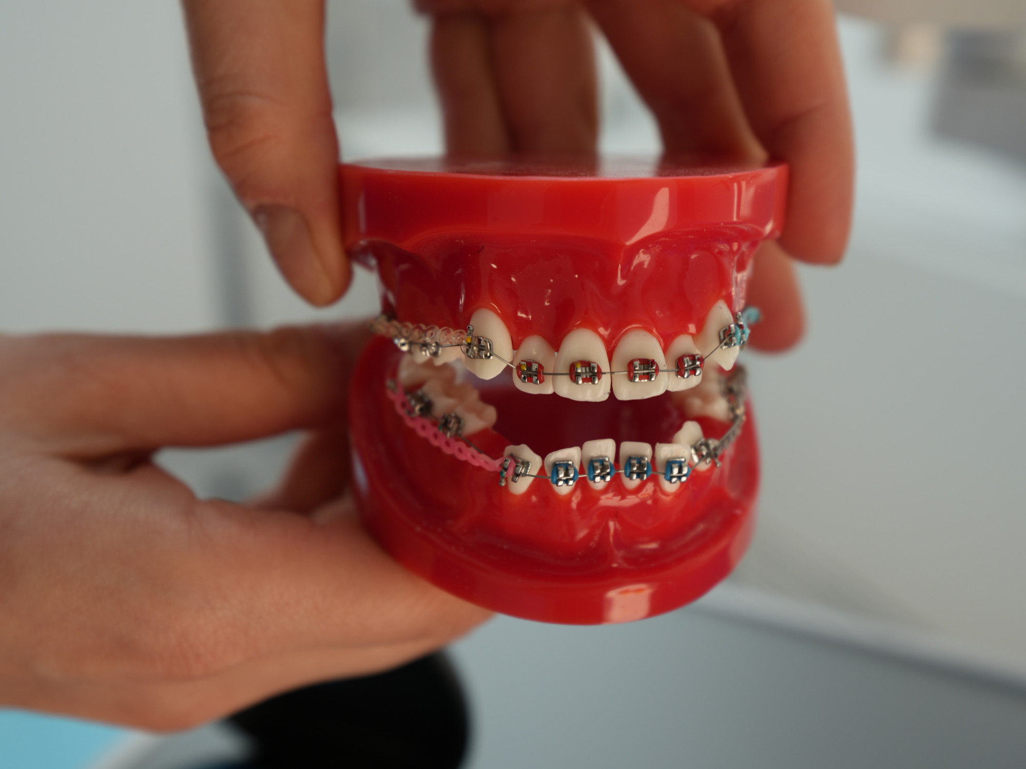 International Dental Clinic - Alignere ortodontice pentru adulți